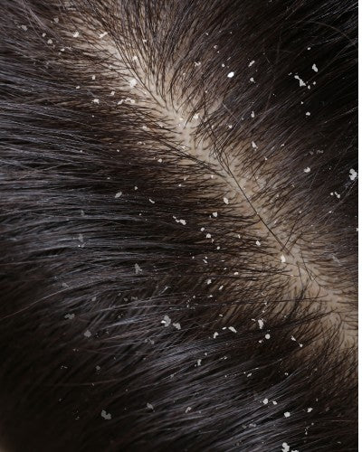 Shampoo Per Cuoio Capelluto Sensibile